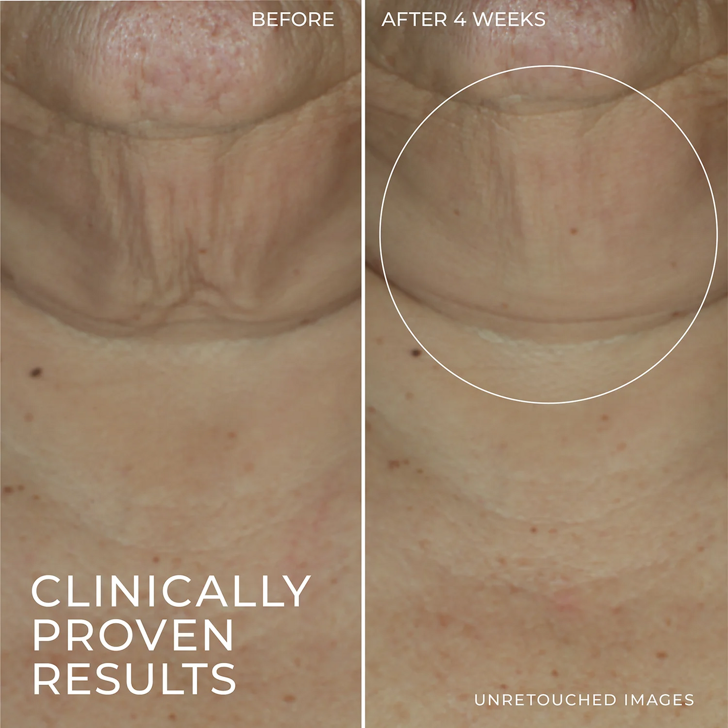 DERM CORREXION® Firming Serum Stick